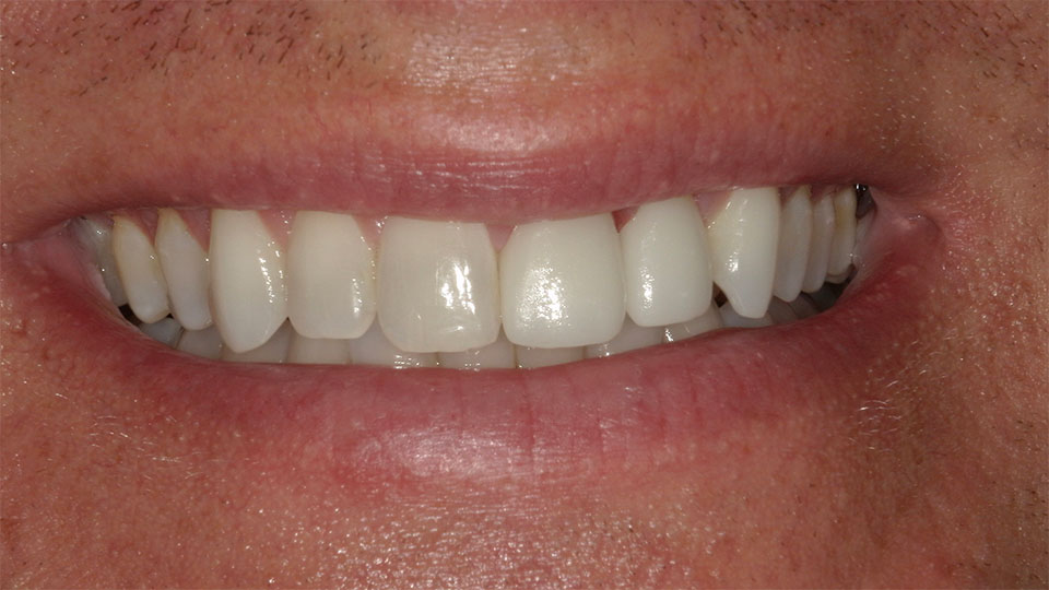 Grand Rapids Dentists Near Me